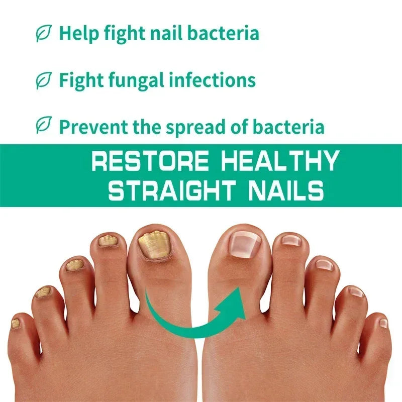 Natural Nail Fungus Treatment Serum