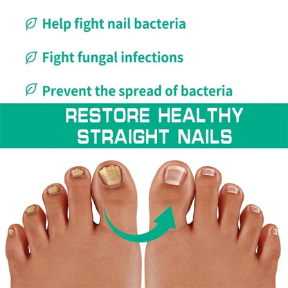 Natural Nail Fungus Treatment Serum