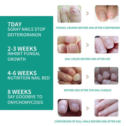 Natural Nail Fungus Treatment Serum