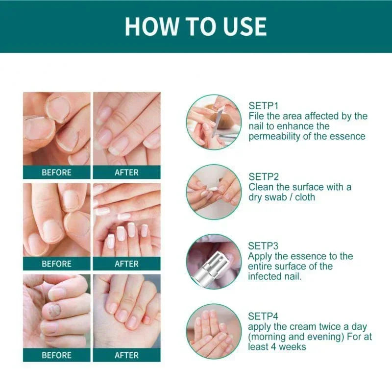 Natural Nail Fungus Treatment Serum