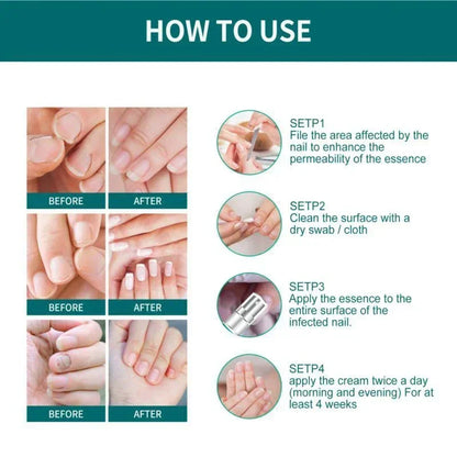 Natural Nail Fungus Treatment Serum