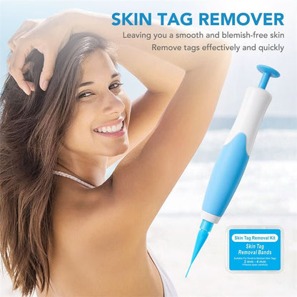 Effective Wart and Mole Remover Cream