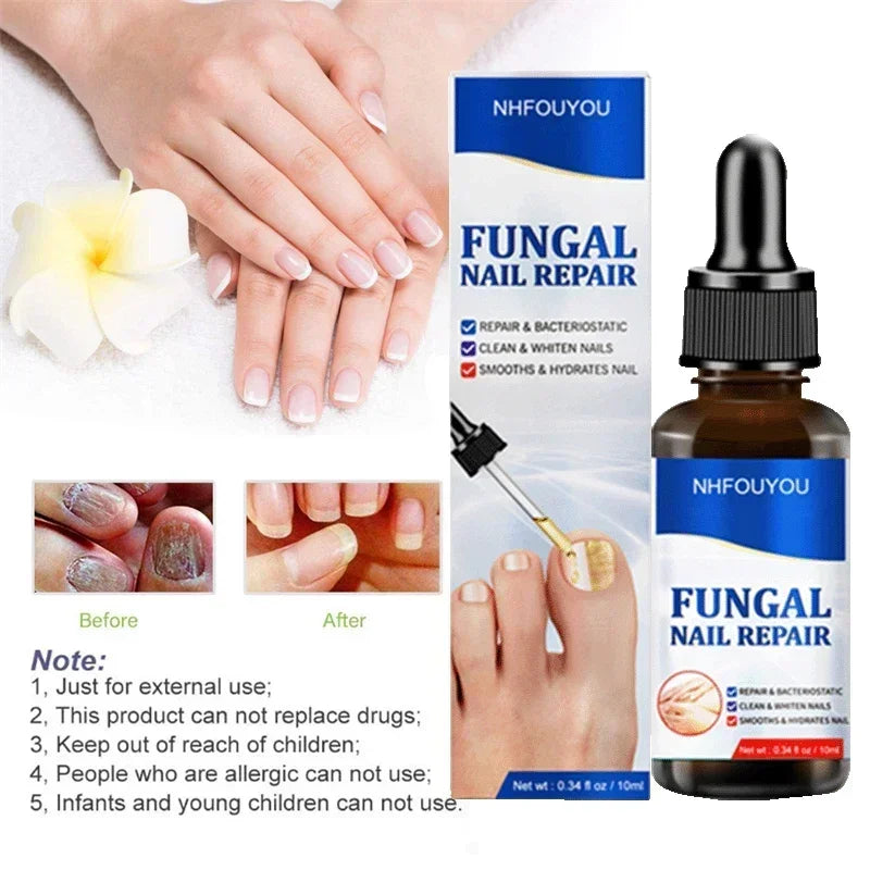 Natural Nail Fungus Treatment Serum