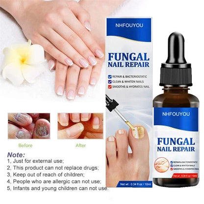 Natural Nail Fungus Treatment Serum