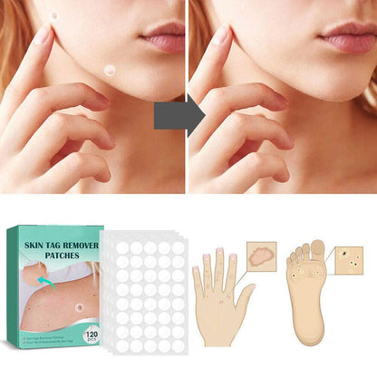 Fast Spot and Wart Removal Plaster