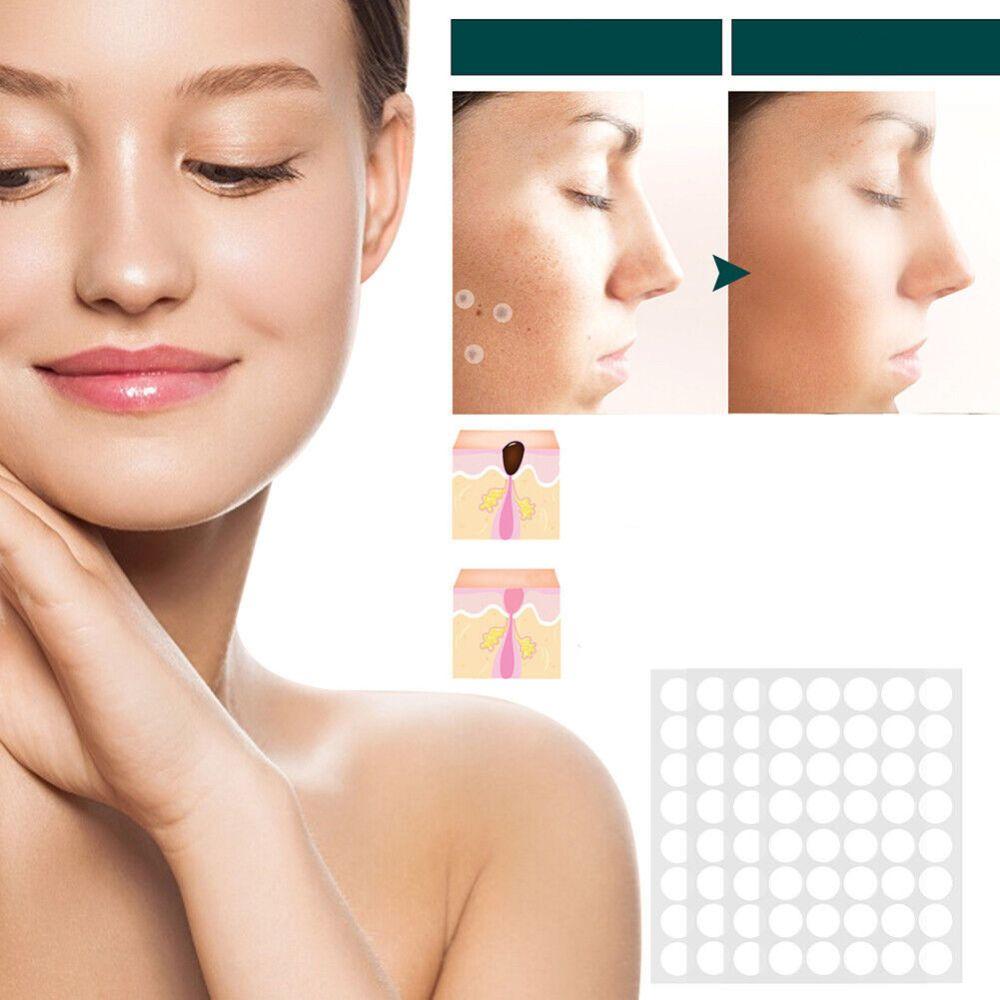 Fast Spot and Wart Removal Plaster
