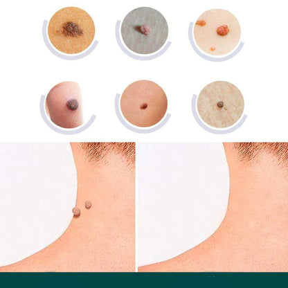 Fast Spot and Wart Removal Patch
