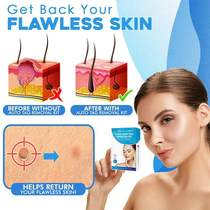 Easy Adhesive Remover Kit