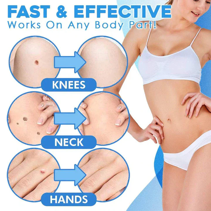 Easy Adhesive Remover Kit