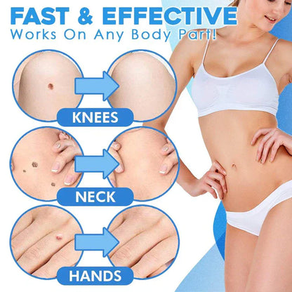 Easy Adhesive Remover Kit
