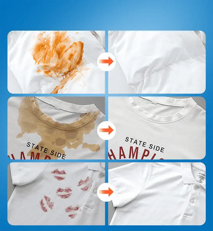 Easy Stain Remover Spray - Fast & Gentle