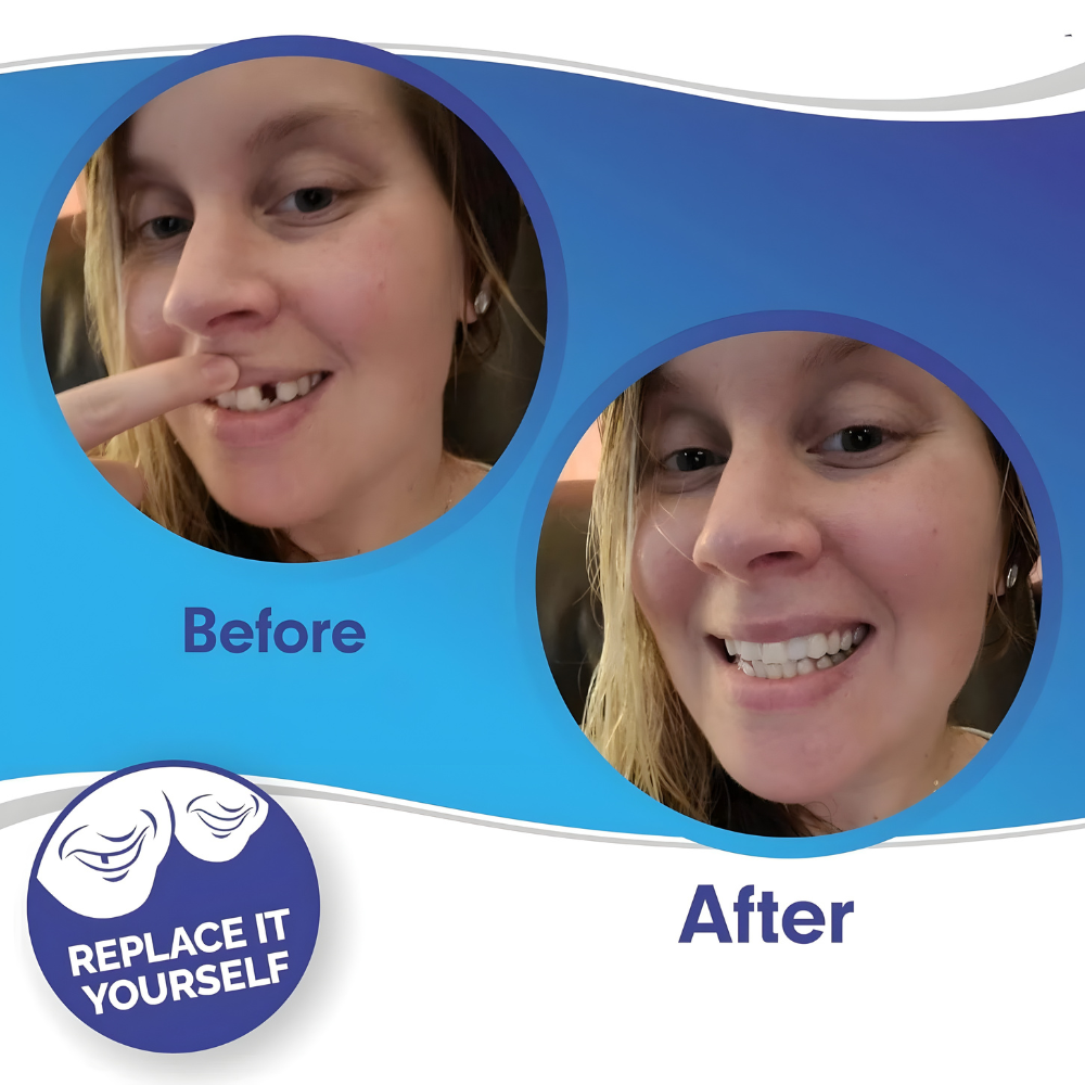 Snap On Smile Dental Veneers Cover