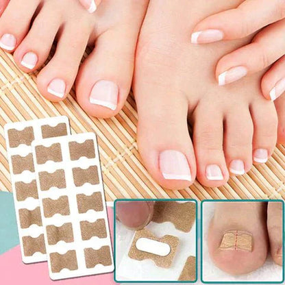 Easy Nail Correction Strips for Ingrown Toenails - Cofik