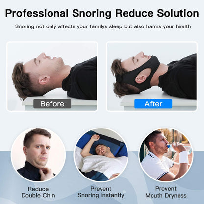 Anti-Snoring Strap – Comfort and Effectiveness for Peaceful Nights