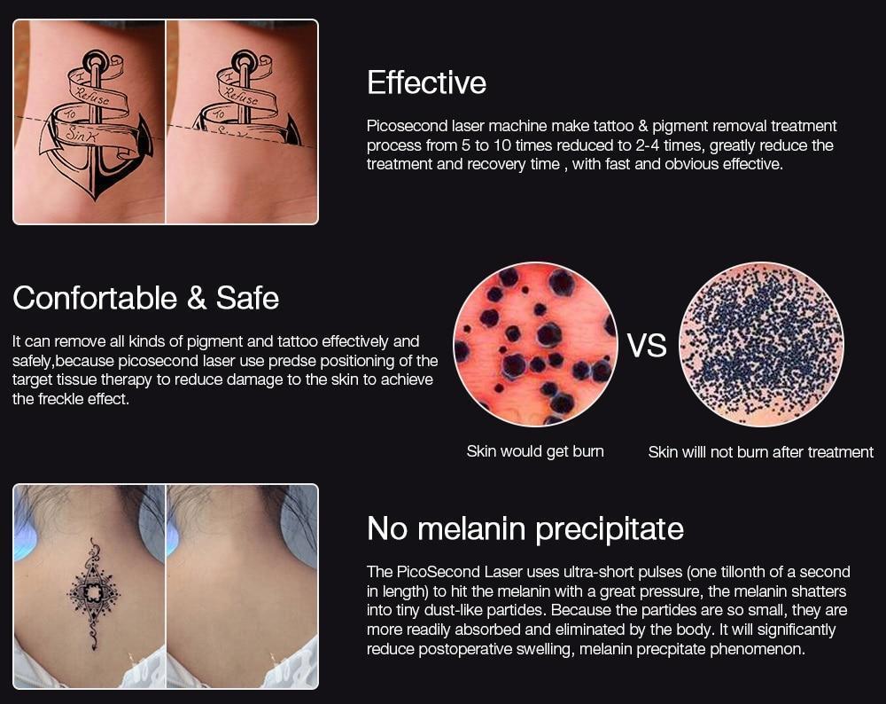 Fast Laser Skin Spot Tattoo Removal Device