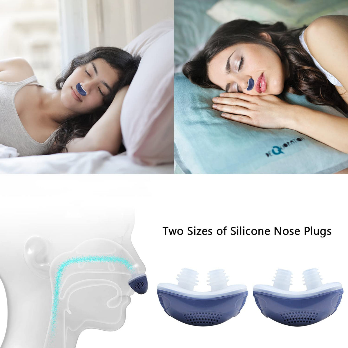 Charly | Anti-Snoring Device | Tubeless, Maskless Micro-CPAP