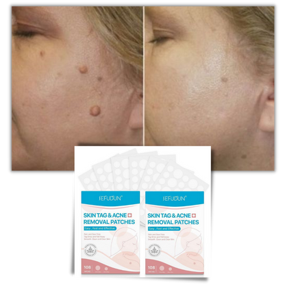 Charly | Skin Patch - Remove Moles and Warts Naturally!