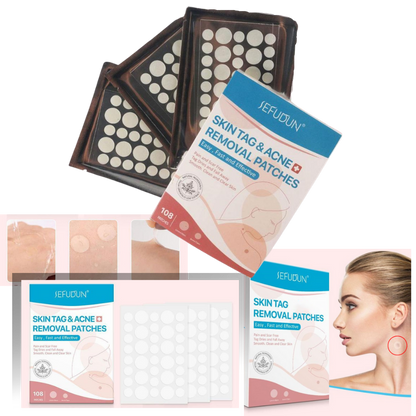Charly | Skin Patch - Remove Moles and Warts Naturally!