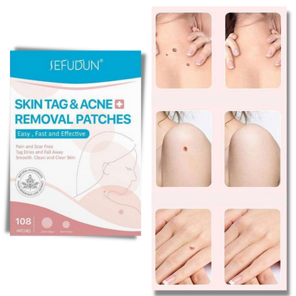 Charly | Skin Patch - Remove Moles and Warts Naturally!