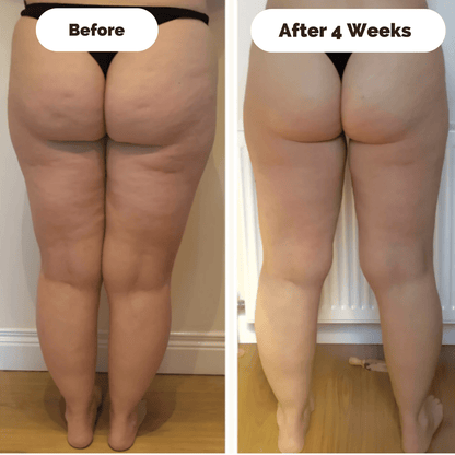 Cofik | Anti Cellulite Massager for Smoother Skin
