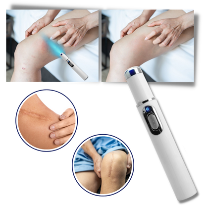 DermaPure | Portable Laser Therapy for a Brighter Complexion