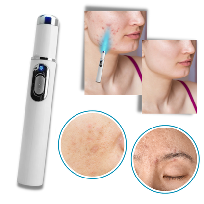 DermaPure | Portable Laser Therapy for a Brighter Complexion