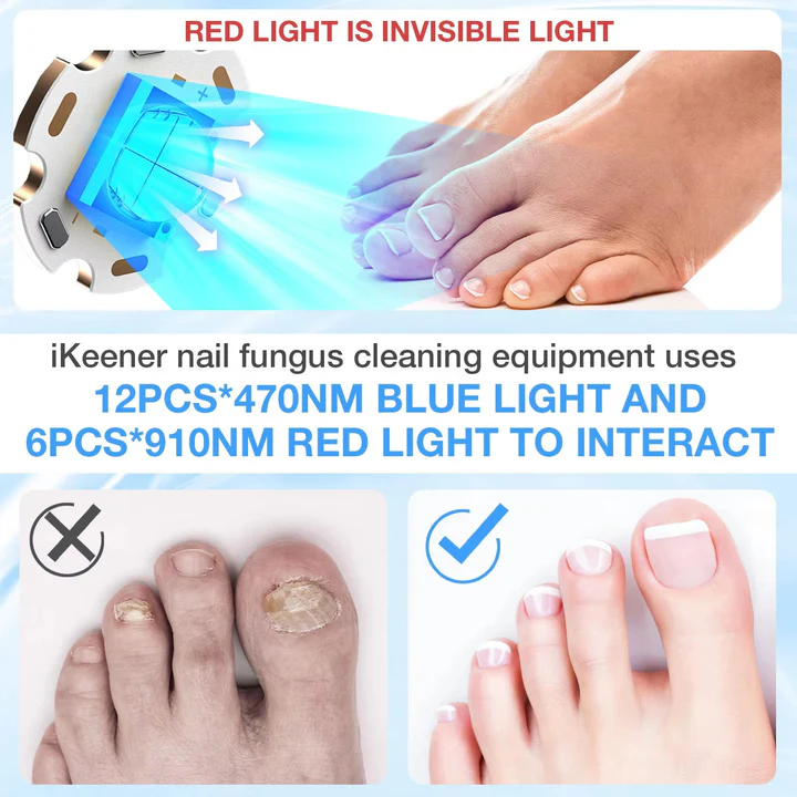 Effective Toenail Fungus Removal Laser