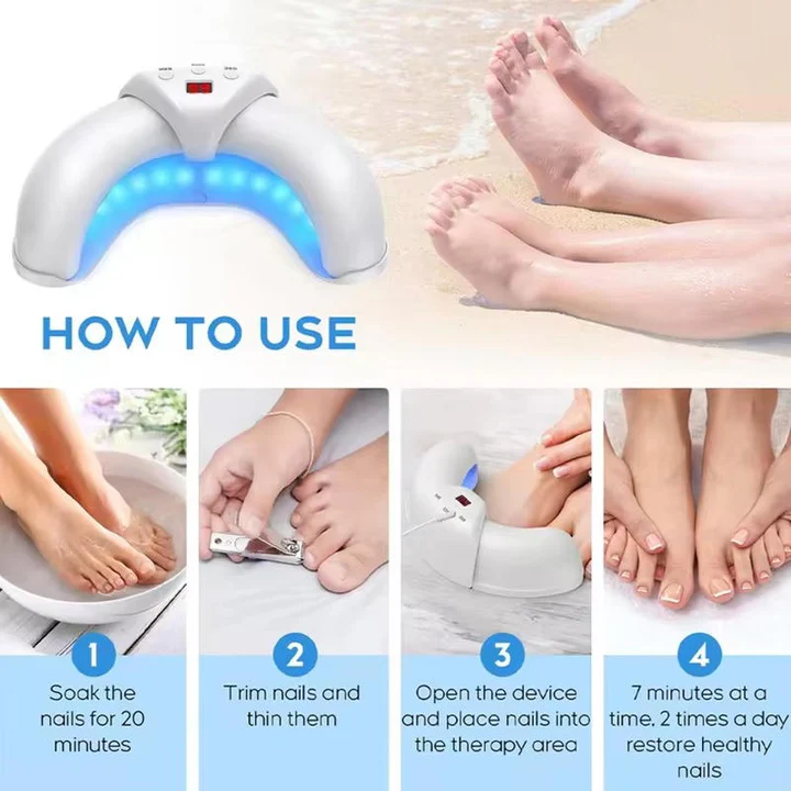 Effective Toenail Fungus Removal Laser
