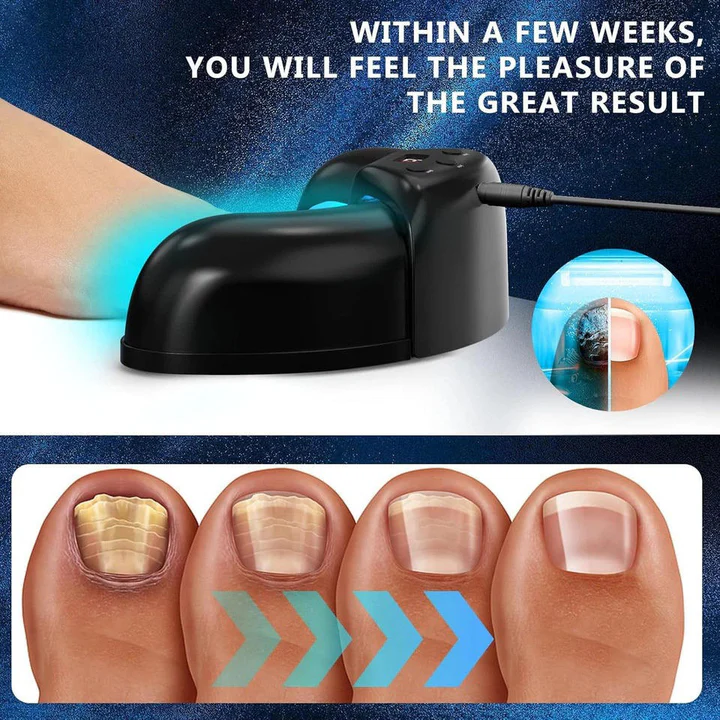 Effective Toenail Fungus Removal Laser