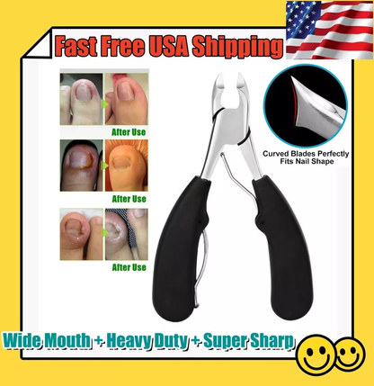Easy Grip Toenail Clipper for Thick Nails