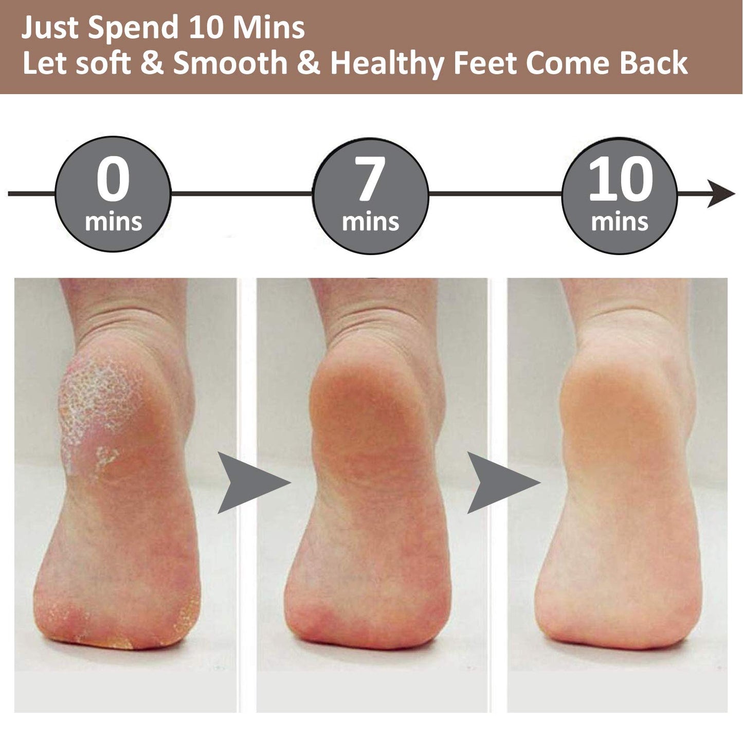 Professional Electric Foot Exfoliator Machine