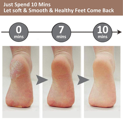 Professional Electric Foot Exfoliator Machine