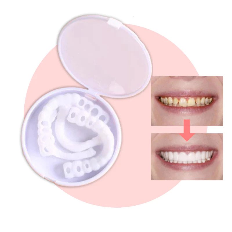 Easy Fit Smile Veneers