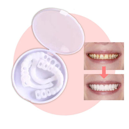 Easy Fit Smile Veneers