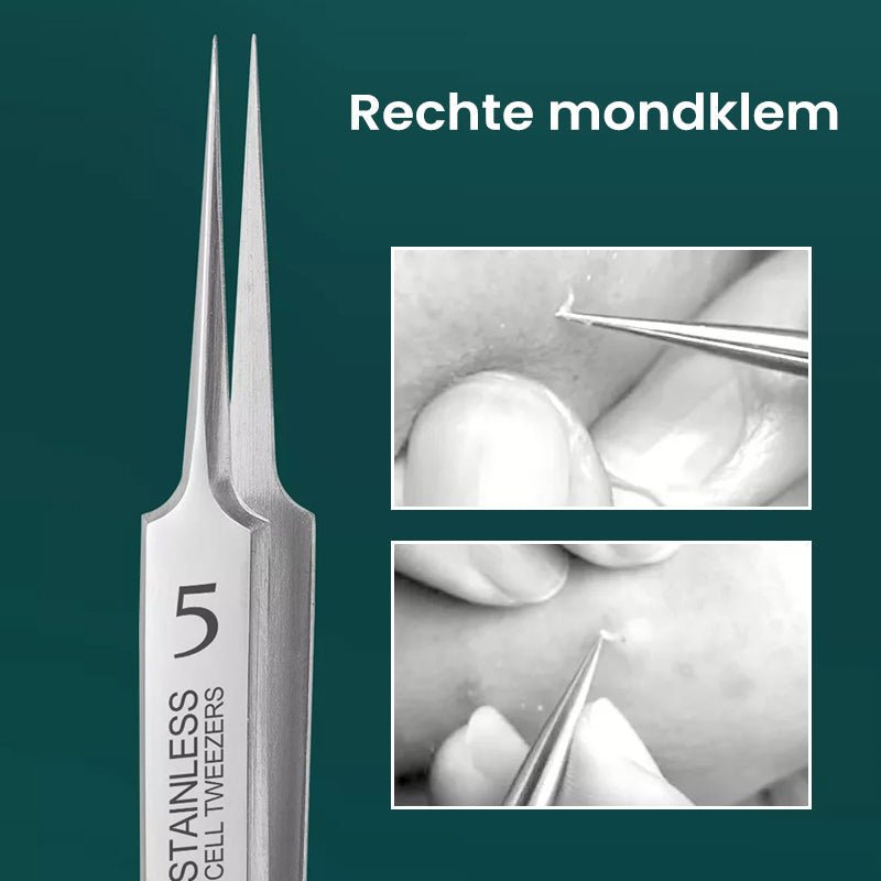 Easy Blemish Remover Tool - Cofik