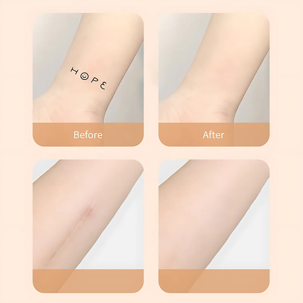 Silky Skin Scar Cover Up Waterproof Patch