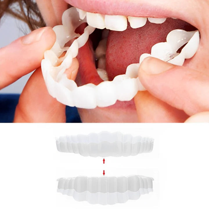 Reusable Snap On Dental Veneers for Upper Lower Teeth - Cofik