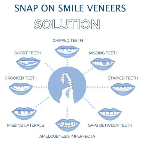 Reusable Snap On Dental Veneers for Upper Lower Teeth