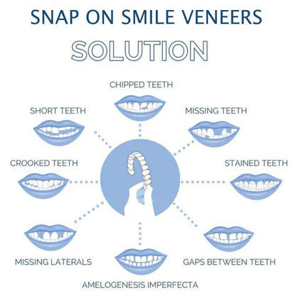 Reusable Snap On Dental Veneers for Upper Lower Teeth