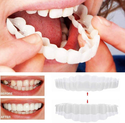 Reusable Snap On Dental Veneers for Upper Lower Teeth