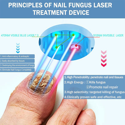 NexaLume At Home Laser Toenail Fungus Treatment Device