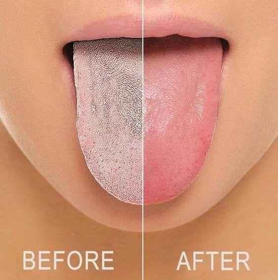 Flexible Dental Mouth Guard - Cofik