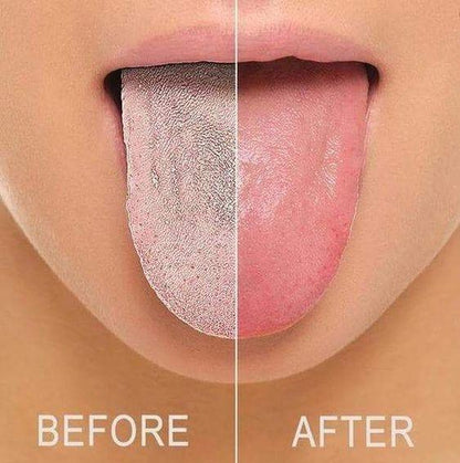 Flexible Dental Mouth Guard - Cofik