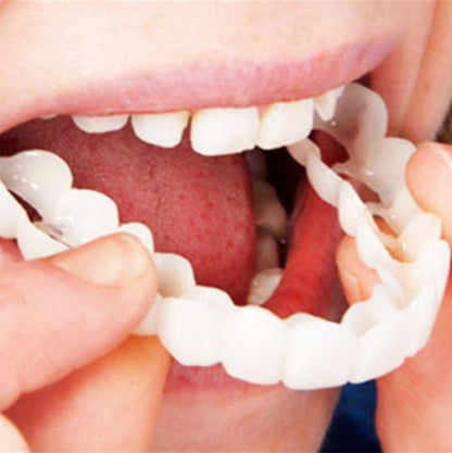 Easy Fit Smile Veneers